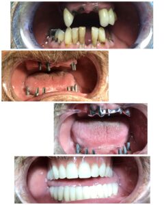 collage_export_43BBA736-9230-4F62-9425-7E789995B58E